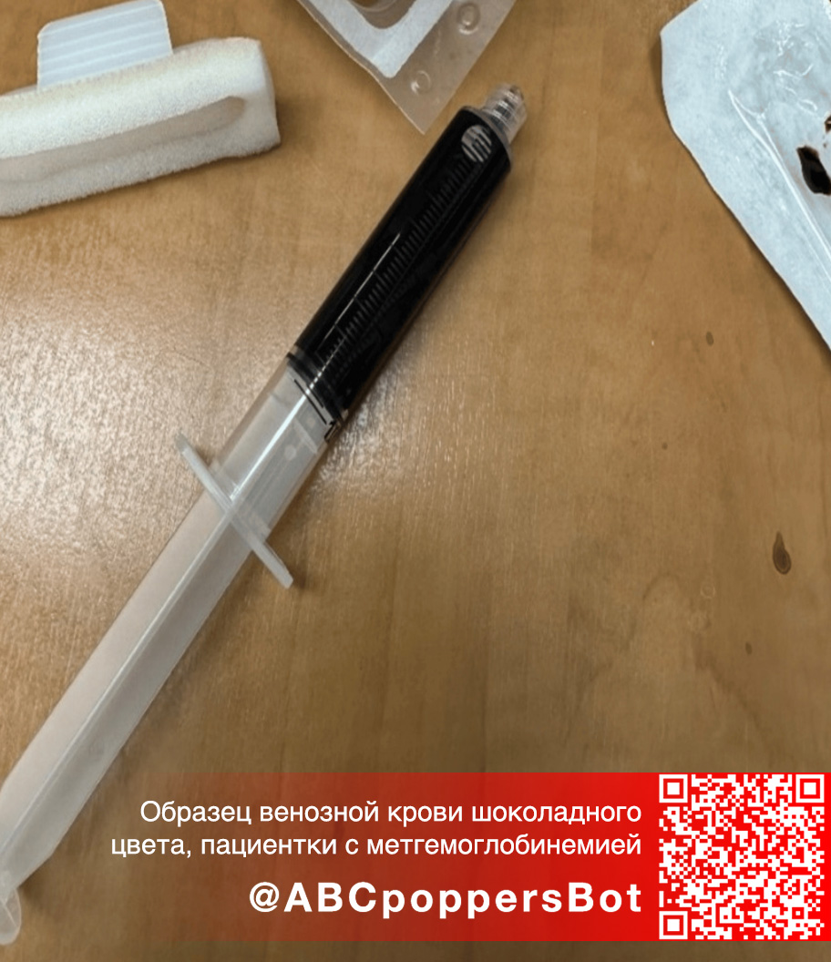 Если принять попперс внутрь в Челябинске это вызывает метгемоглобинемию. Смертельное состояние Если принять попперс внутрь в Челябинске это вызывает метгемоглобинемию. Смертельное состояние